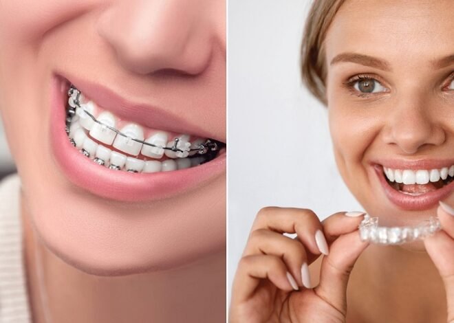 Affordable Orthodontist Care for a Healthier Smile