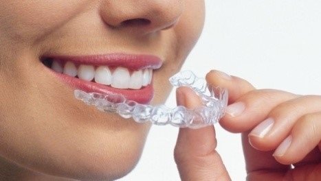 Everything You Need to Know About Modern Orthodontic Care