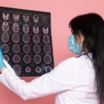 How to Choose the Right Brain Injury Attorney for Your Case