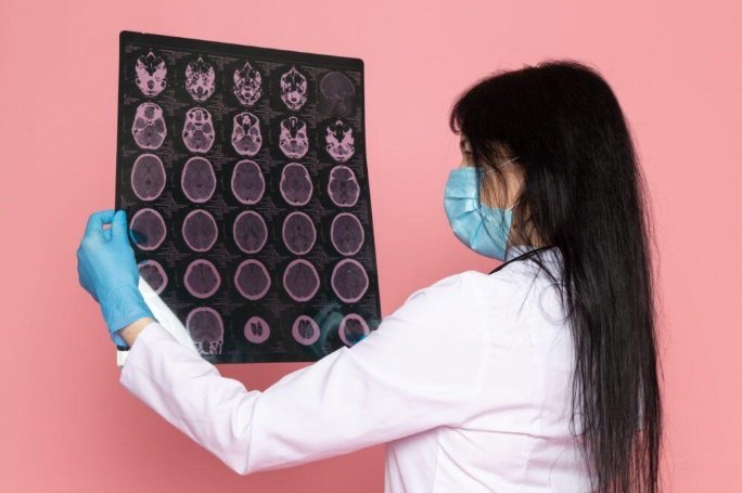 How to Choose the Right Brain Injury Attorney for Your Case